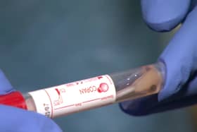 Coronavirus Covid-19 testing has reached 1,000