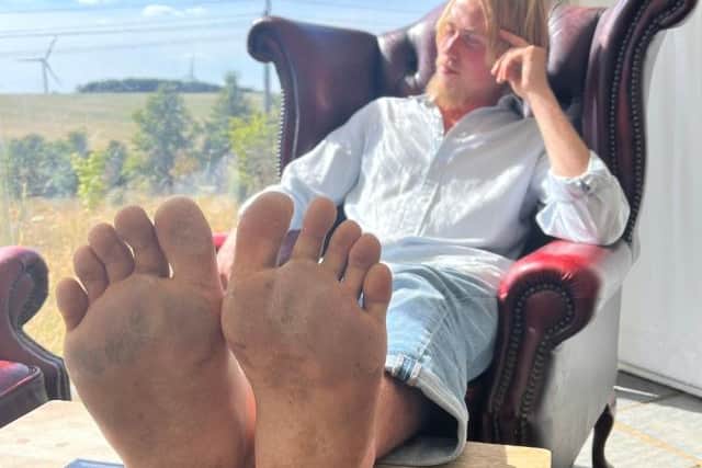 “I decided at that moment that I wouldn’t ever wear shoes again.”
