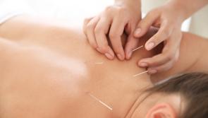 Acupuncture and Homeopathy - Holistic Treatments in the heart of Limerick City