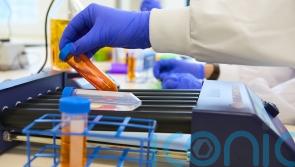 Tipperary TD says patients are waiting up to four months for results of biopsies