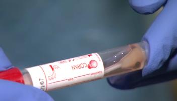 Covid-19 hospital patient numbers continue to rise