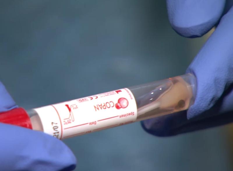 Omicron wave 'may have peaked' says immunology professor 