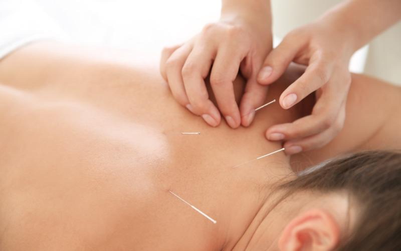 Acupuncture and Homeopathy - Holistic Treatments in the heart of Limerick City